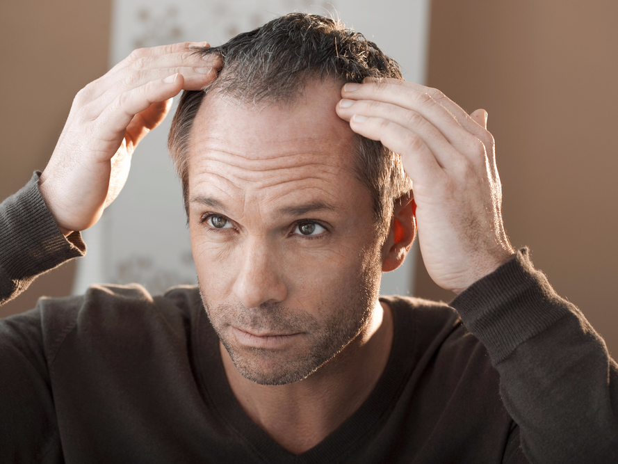  cure your baldness